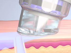 Step 4: INSTANT HYDRATION